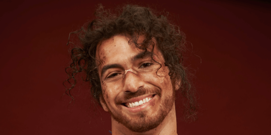 A man with curly brown hair, a wide grin, and a plaster on his nose.